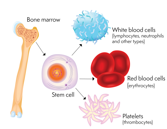 lymphoma-action-bone-marrow-biopsy